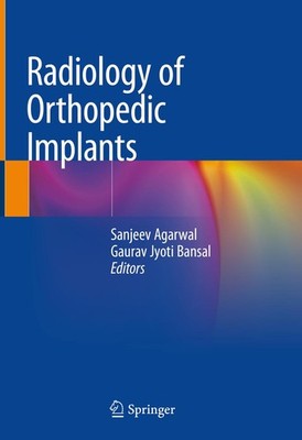 Radiology of Orthopedic Implants Sanjeev Agarwal
