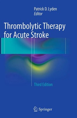 Patrick D Lyden | Thrombolytic Therapy for Acute Stroke | Taschenbuch | Englisch