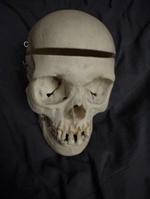 Human Skull Anatomical Model for Anatomy, Removable Hinged Calvarium Skullcap