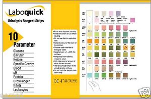 Urine Dipstick Chart Uk