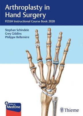 Arthroplasty in Hand Surgery | Stephan Schindele (u. a.) | Bundle | 1 eBook
