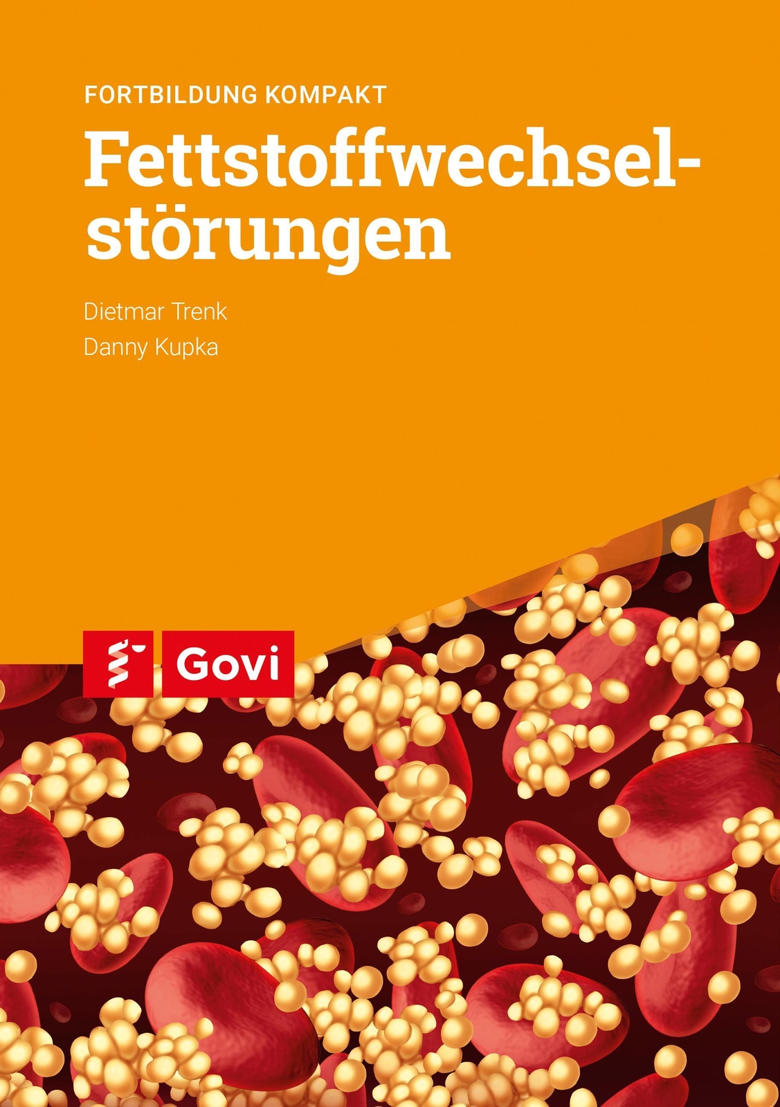 Thumbnail - Dietmar Trenk (u. A.) | Fettstoffwechselstörungen | Taschenbuch |
