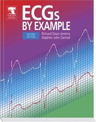 EKGs nach Beispiel