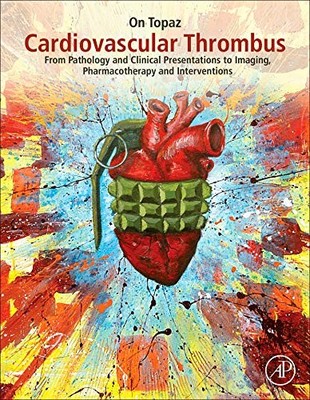 CARDIOVASCULAR THROMBUS: FROM PATHOLOGY AND CLINICAL By On Topaz - Hardcover