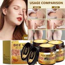 Bee Venom Skin Restoration Cream, Professional Bee Venom Skin Treatment Cream US