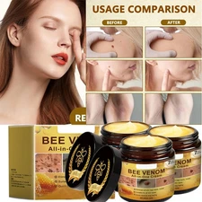Bee Venom Skin Restoration Cream, Professional Bee Venom Skin Treatment Cream US