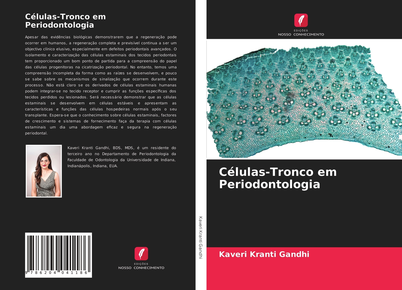 Kaveri Kranti Gandhi | Células-tronco Em Periodontologia | Taschenbuch