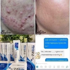 Dr.Tiara Highrosone Cream ( For Day&Night ) Buy 5 Get 1 Free