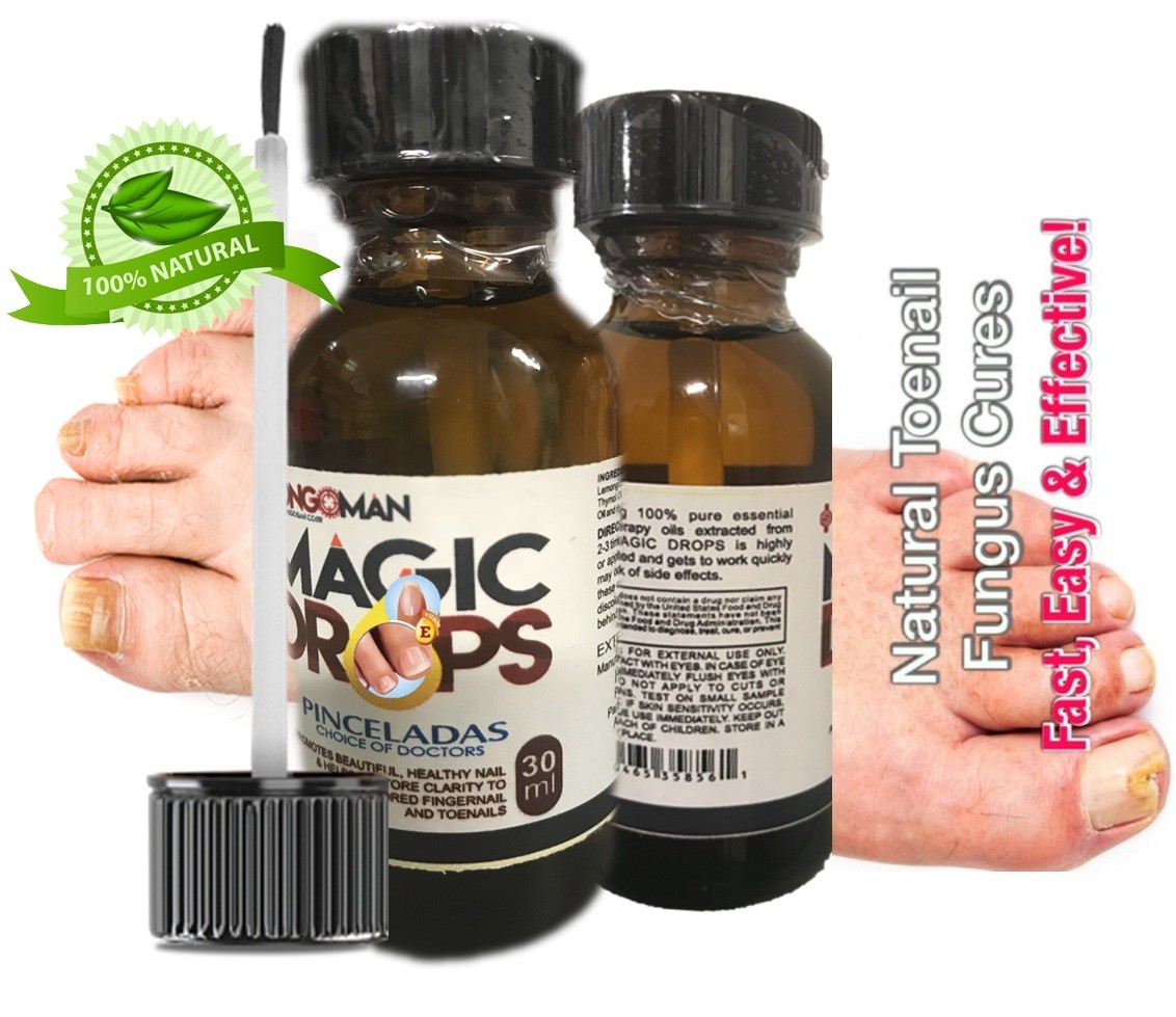 nail fungus Support Athletes foot fungus toe Zana skin nail quick eBay