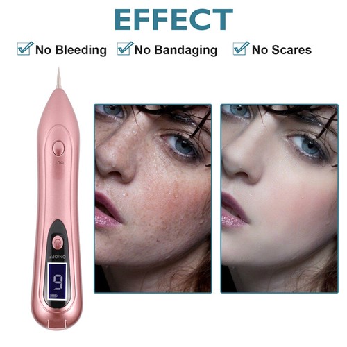 LCD Laser Plasma Pen Mole Removal Dark Spot Skin Tag Tattoo Wart Remover Machine - Picture 9 of 14