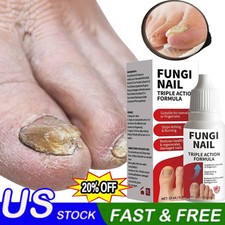 Fungi-Nail Anti-Fungal Liquid Solution Kills Fungus That Can Lead To Nail HOT 