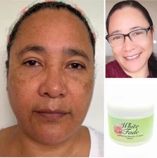 W.F.C : Eliminan Las Manchas Oscuras, Especial Para Piel Morena o Triguena 2oz.