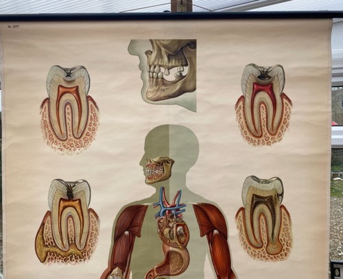 DE COLECCIÓN ESCUELA ANATÓMICA TABLA DE DIENTES HUMANOS PAPEL SOBRE LIENZO - Imagen 3 de 12
