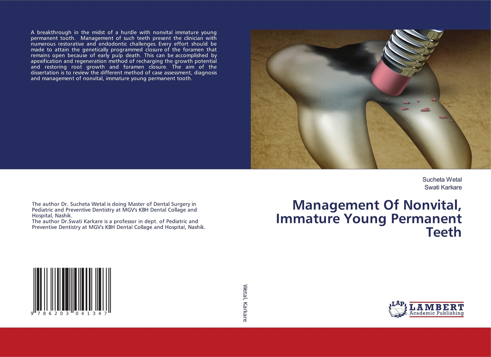 Sucheta Wetal (u. A.) | Management Of Nonvital, Immature Young