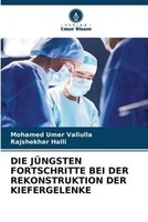 Mohamed Umer Valiulla (U. A.) | DIE JÜNgsten Fortschritte BEI Der...