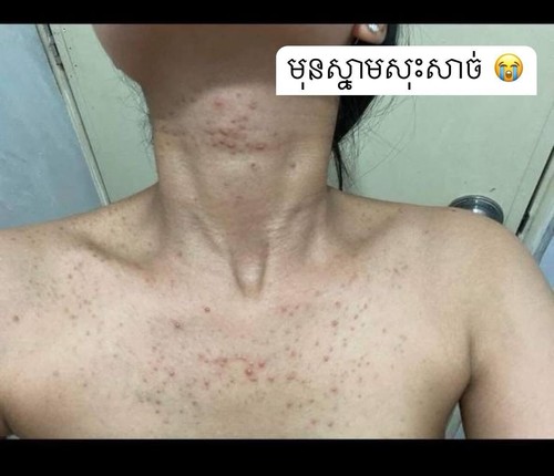 Felix Multi Vitamin Body Lotion ឡេលាបខ្លួន ហ្វីលិច ( 1b/500g ) - Picture 13 of 15
