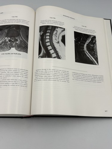 Magnetic Resonance Imaging of CNS Disease: A Teaching File, By: Yock (1995) HC - Imagen 13 de 13