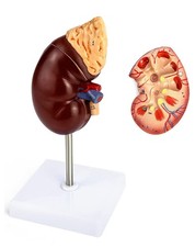 QWORK Life-Size Kidney Model, Divided into 2 Parts Showing Internal...