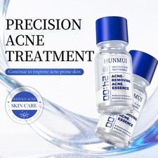 Acne Essence Salicylic Acid Serum for Acne 10ml Anti-acne Serum