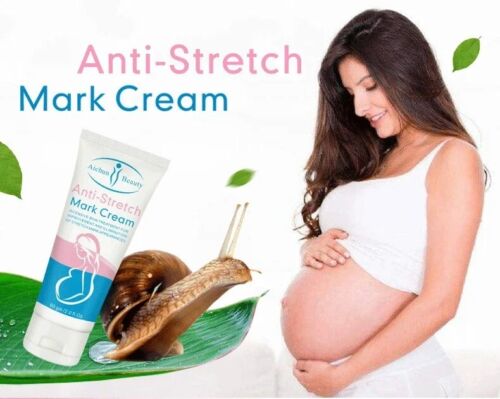 Pregnancy Scar Repair Cream Stretch Marks Removal Fat Stretch Mark Treatment NEW - Picture 3 of 11