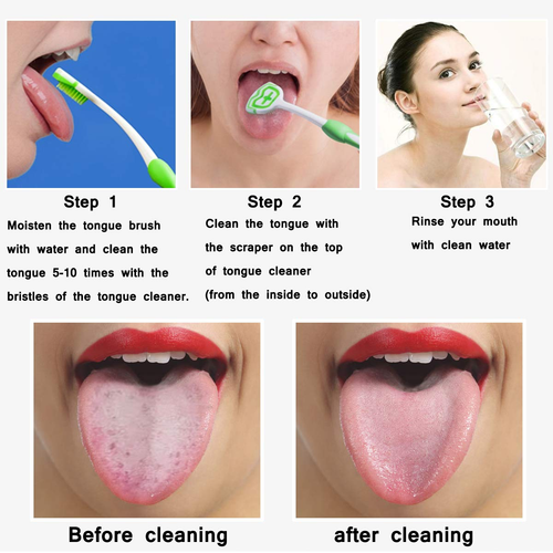 Tongue Brush, Tongue Scraper, Tongue Cleaner Helps Fight Bad Breath, 3 Tongue Sc - Picture 3 of 12