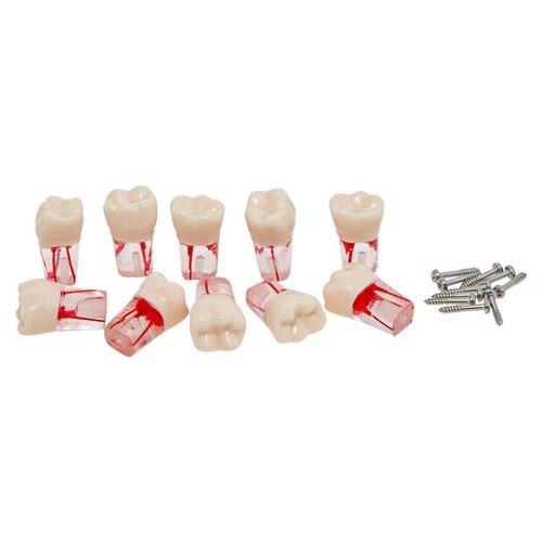 10 piezas modelo dental endodontal de conducto radicular estudio ECA práctica modelo #8006 - Imagen 77 de 80