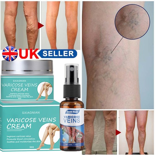 Varicose Veins Miracle Ointment Cream Gel Veinhealing Varicose Treatment Spray eBay