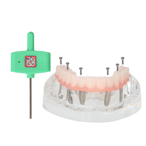 US Dental Overdenture Restoration Teeth Model Upper Jaw Type With 4/6 Screws - Picture 29 of 39