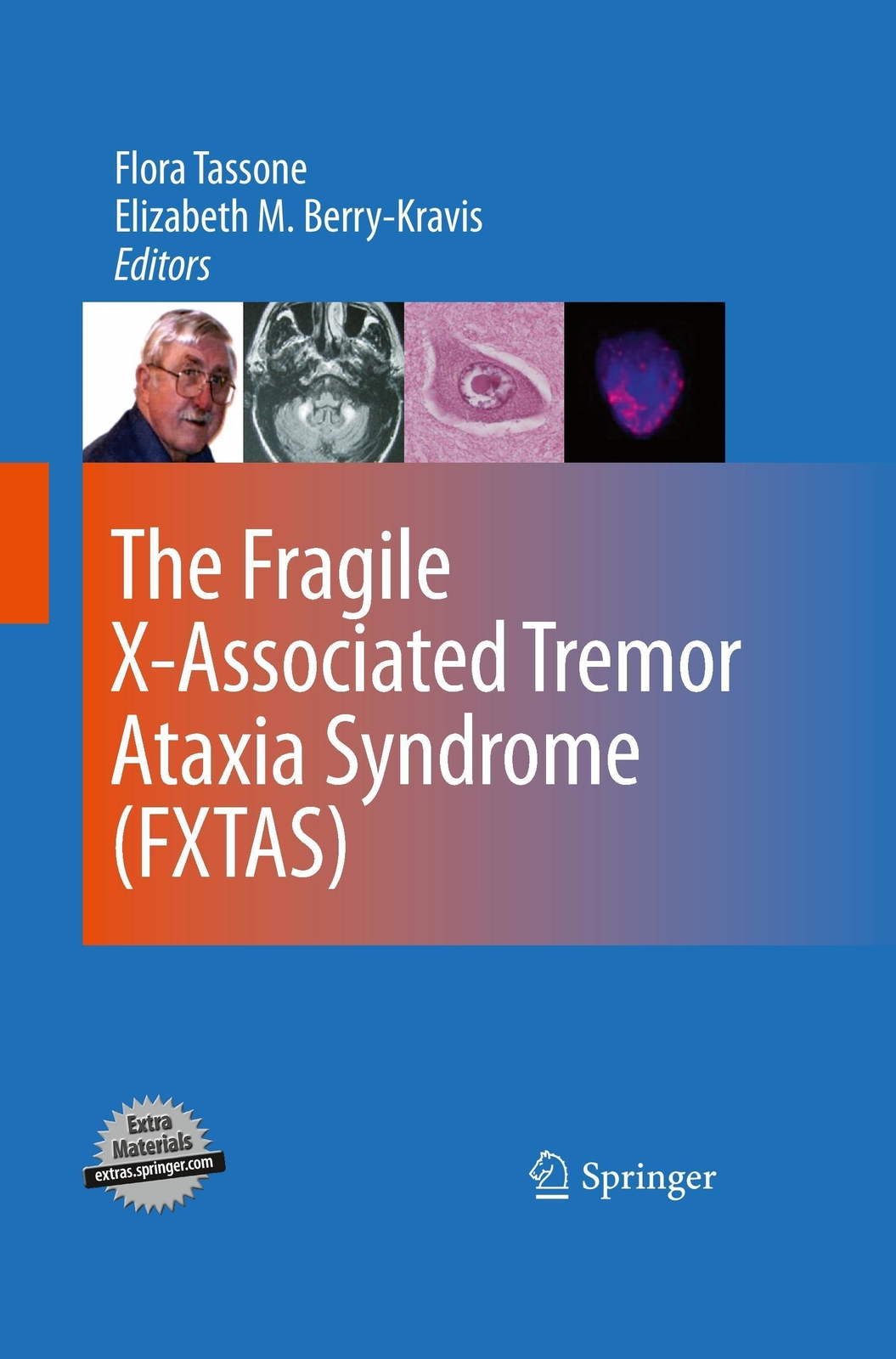 Thumbnail - Elizabeth M. Berry-kravis (u. A.) | The Fragile X-associated Tremor