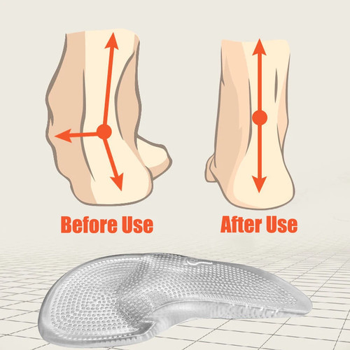 1 Pair Orthopedic Silicone Insoles for Flat Feet Arch Support Shoe Pain Relief - Picture 4 of 8