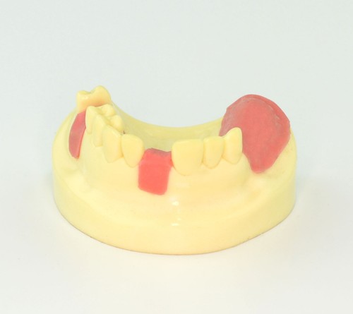 Modelo de implante dental faltante entrenamiento mandíbula superior odontología modelo educativo - Imagen 3 de 9