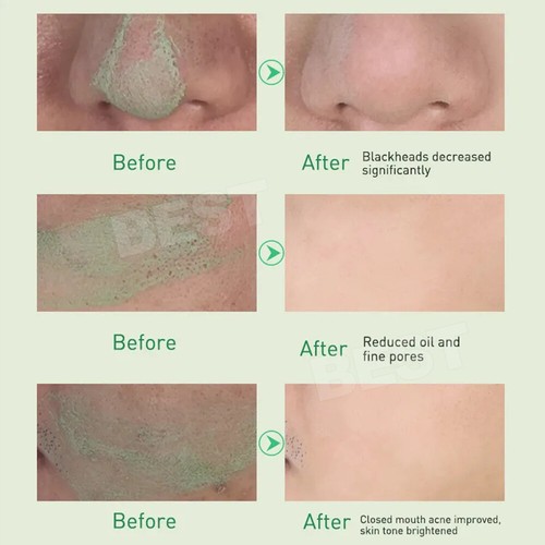 Up To 4x Green Tea Cleansing Mask Facial Stick Oil Acne Control Blackhead AUS - Picture 7 of 12