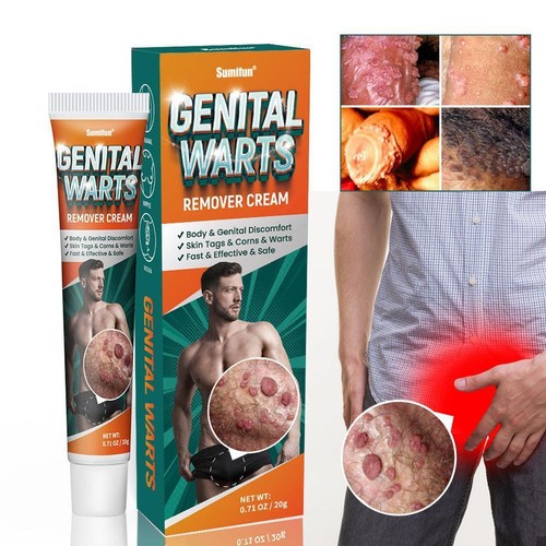Sumifun Genital Wart Removal Cream Relieve Discomfort Fast, B8S0 K9Y6 X6X6 N4A7 - Bild 6 von 8