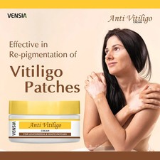 VENSIA Anti Vitiligo Cream | White Patches & ...