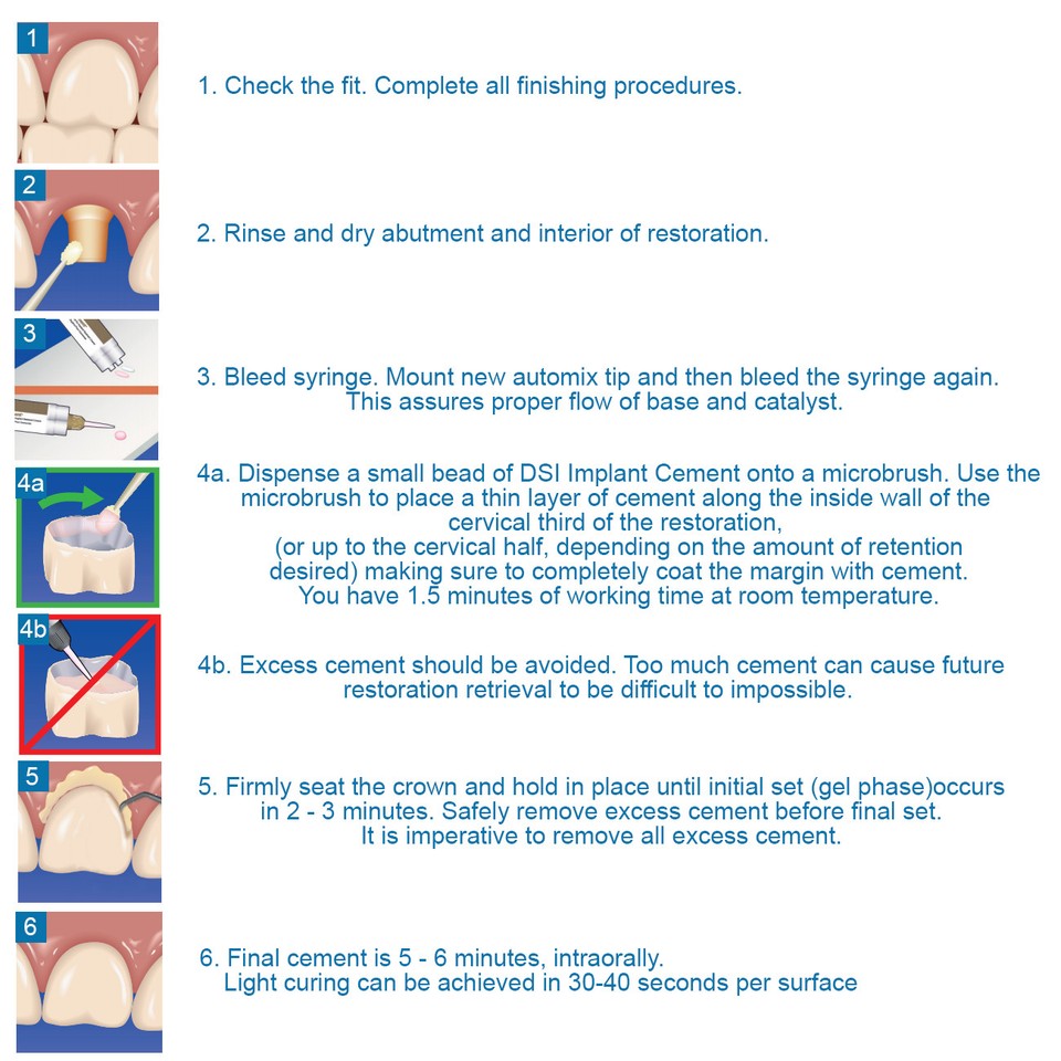 Permanent Dental Adhesve for Crown and Brdge Phlppnes | Ubuy