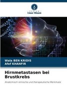 Hirnmetastasen Bei Brustkrebs Wala Ben Kridis