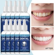 10/8Pcs Dental Care Solution Mouth Protection Cleaning Serum for Oral Care 60ml