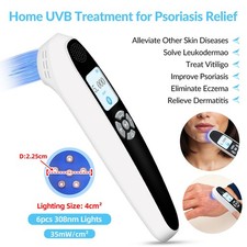 Handheld 308nm Narrowband UVB Phototherapy Device For Skin Diseases Treatment