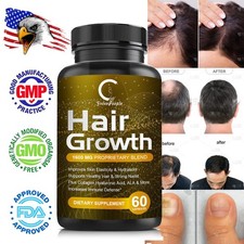 Advanced Anti Hair Loss Capsules DHT Blocker Fast Hair Growth Vitamins Pills