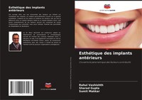 EsthéTique Des Implants AntéRieurs Rahul Vashishth (U. A.) Taschenbuch 2025