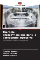 ThéRapie Photodynamique Dans La Parodontite Agressive : Surekha Rathod (U. A.)
