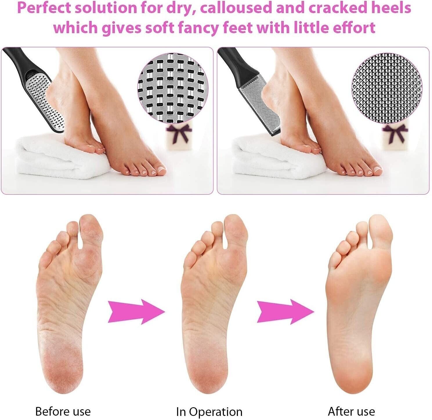 Foot Rasp File Pedicure Callus Remover Hard Dead Skin Scrubber Tool Feet Care US