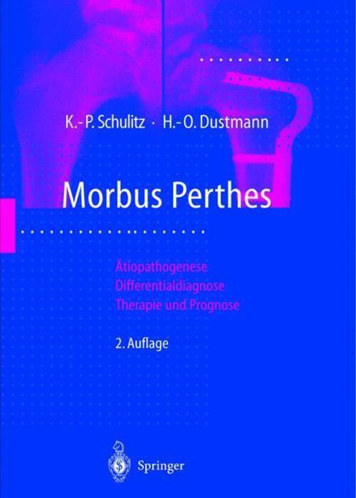 Thumbnail - Hans-otto Dustmann (u. A.) | Morbus Perthes | Taschenbuch | Deutsch