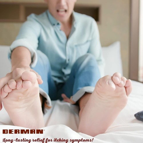 Derman Antifungal Cream. For the Treatment of Athlete's Foot. 1.76 oz. Pack of 3 - Picture 5 of 5