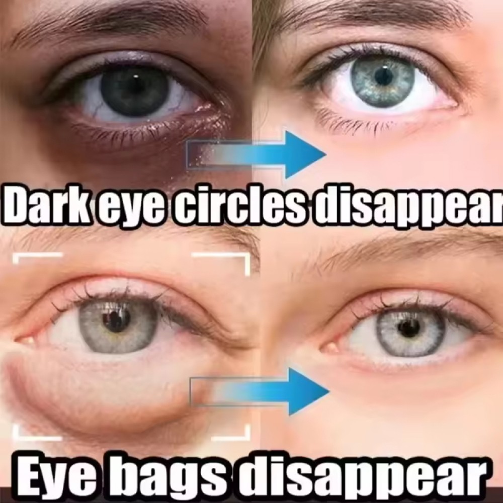 3PCS Firming Eye Serum for Rapid Reduces Under-Eye Bags, Wrinkles, Dark Circles