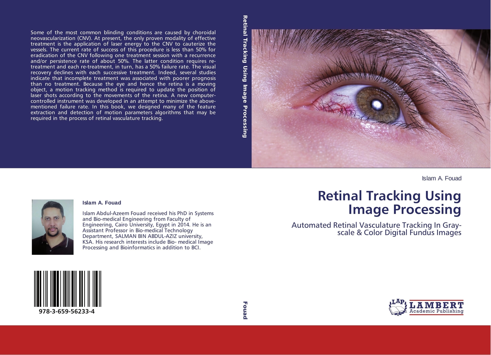 Thumbnail - Islam A. Fouad | Retinal Tracking Using Image Processing | Taschenbuch