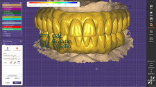 Servizio di Progettazione Remota CAD/CAM – Exocad