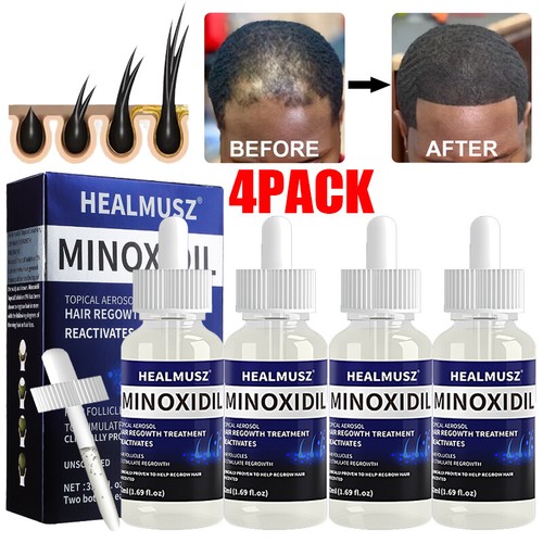 4xExtra Strength Hair Loss&Regrowth Scalp Serum Treatment for Men 4 Month Supply - Picture 4 of 21