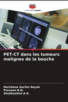 Darshana Sachin Nayak (U. A.) | PET-CT Dans Les Tumeurs Malignes De La Bouche