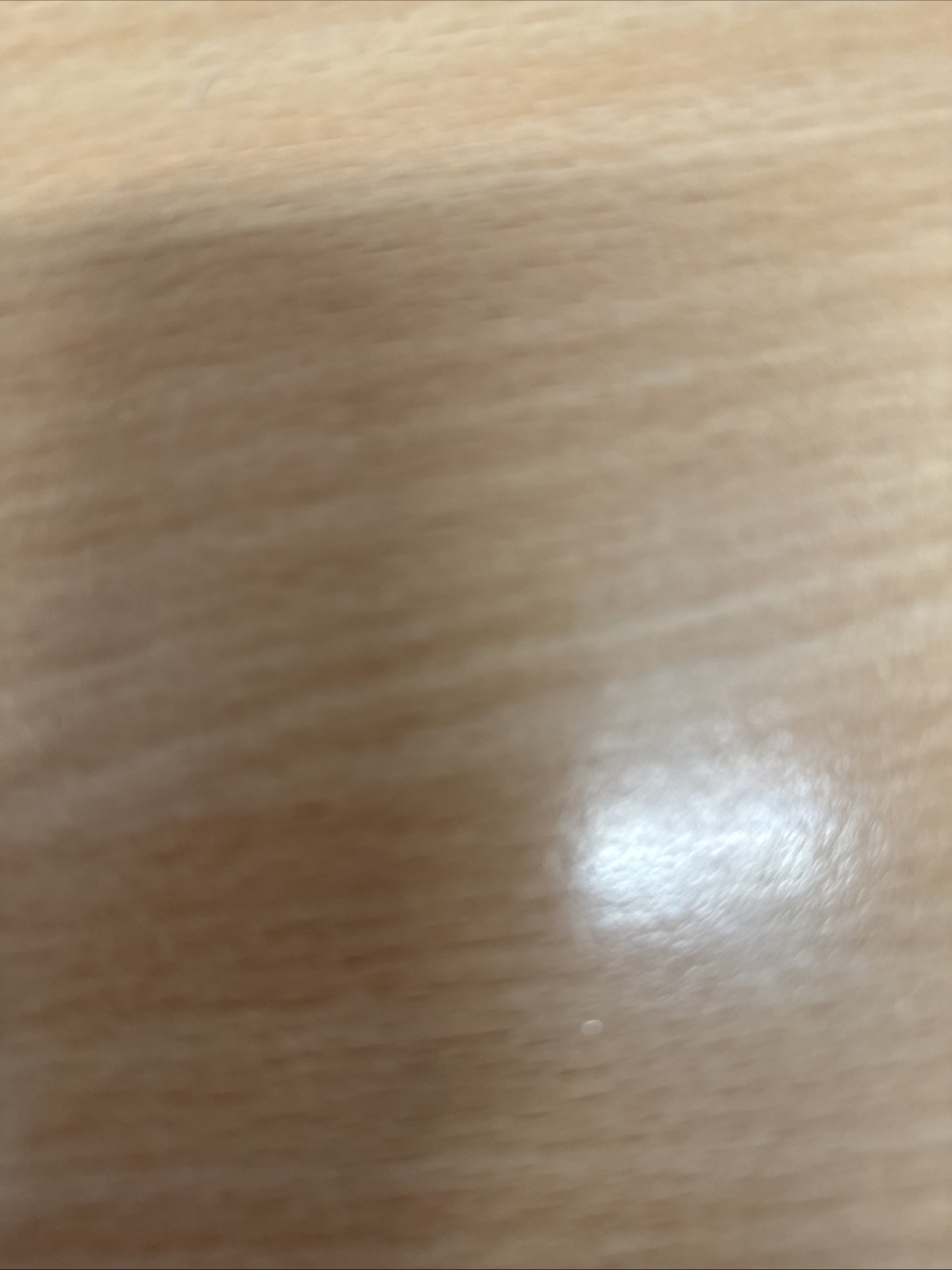 Paquete de 5 - Clips de conexión de manguera genuinos para bañeras de hidromasaje Lazy Spa 32 mm